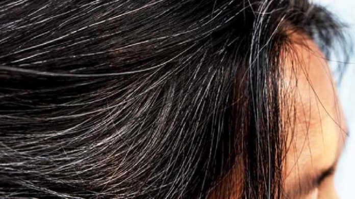 Kaitan Stres Bisa Membuat Rambut Beruban